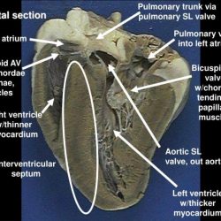 Aortic semilunar valve sheep heart